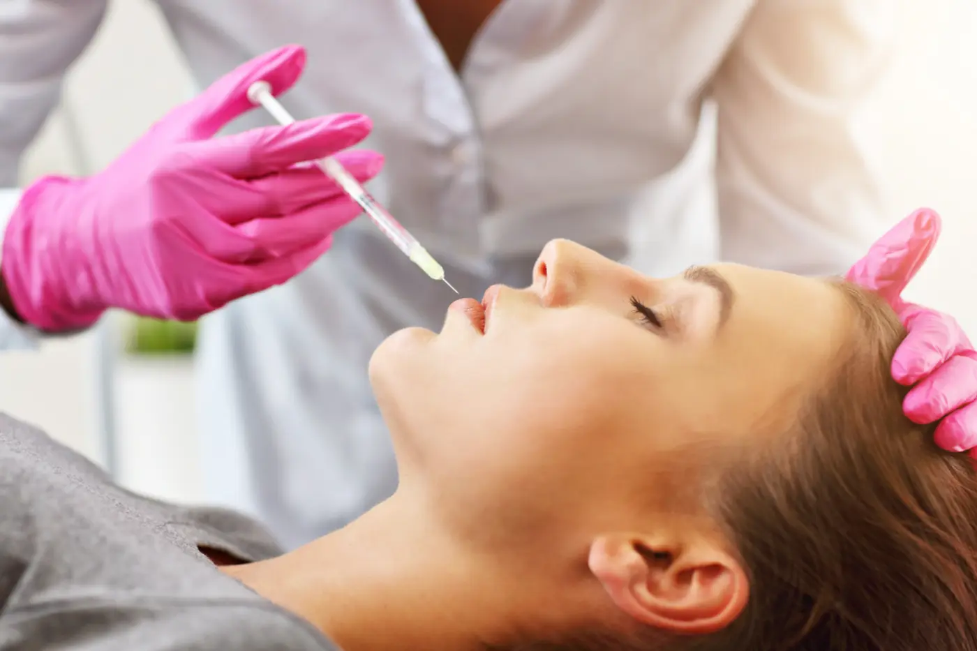 Dermal filler treatment to the lips